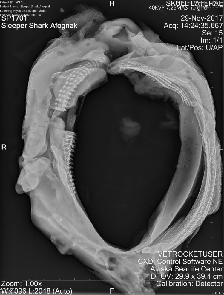 radiograph4_PSS
